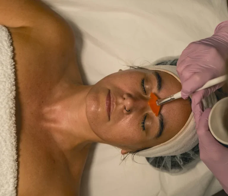 Rejuvenecimiento facial con IPL